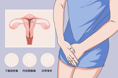 图片[1]_感染盆腔炎怀孕了宝宝能要吗_QQ问问生活